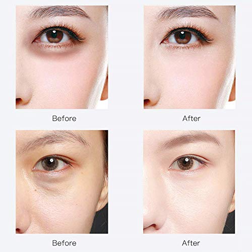 Under Eye Patches,30 pairs Hyaluronic Acid Anti-Aging Under Eye Mask, RABIOTA Collagen Under Eye Gel Pads for Dark Circles, Wrinkles, Fine Line, Puffiness (Blue) - Image 4
